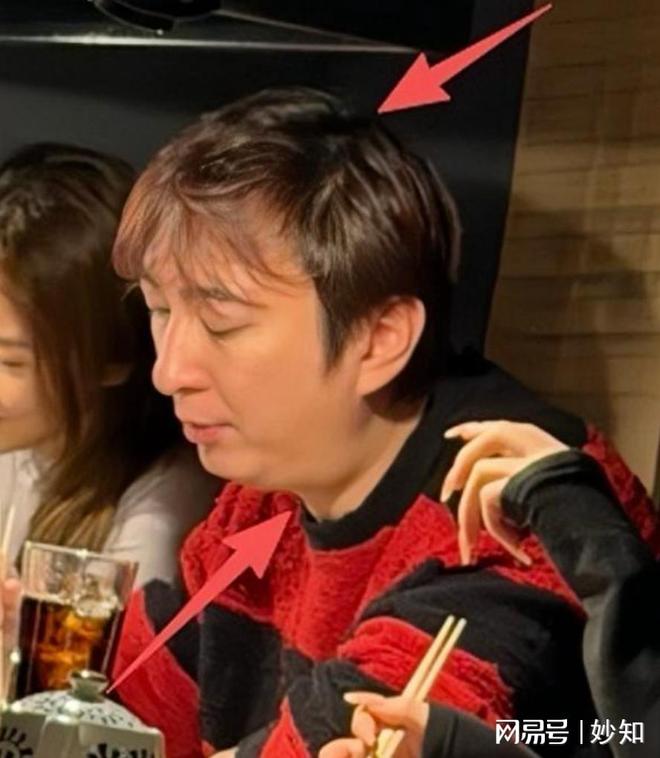 后缩秃头有姨味带五个女伴憔悴不开心开元棋牌37岁王思聪面相变了下巴(图4)